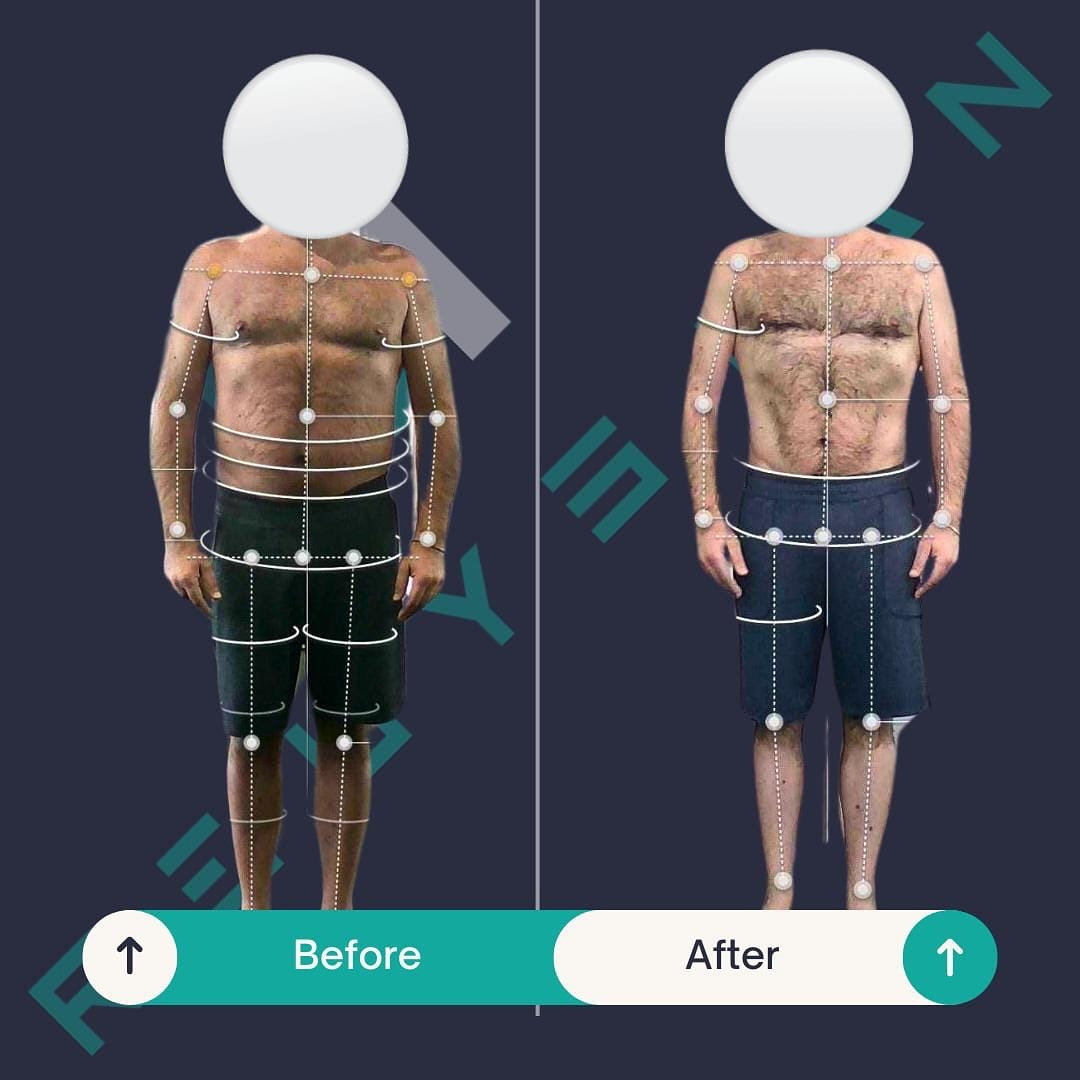 Original anonymised before-and-after comparison over 90 days