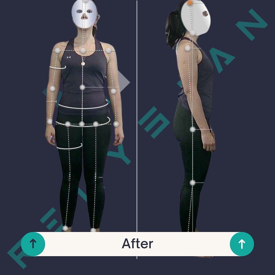 After: original anonymised client photo