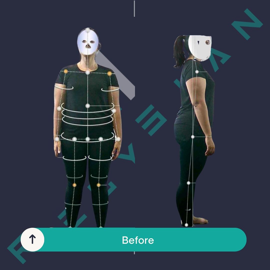Before: original anonymised client photo